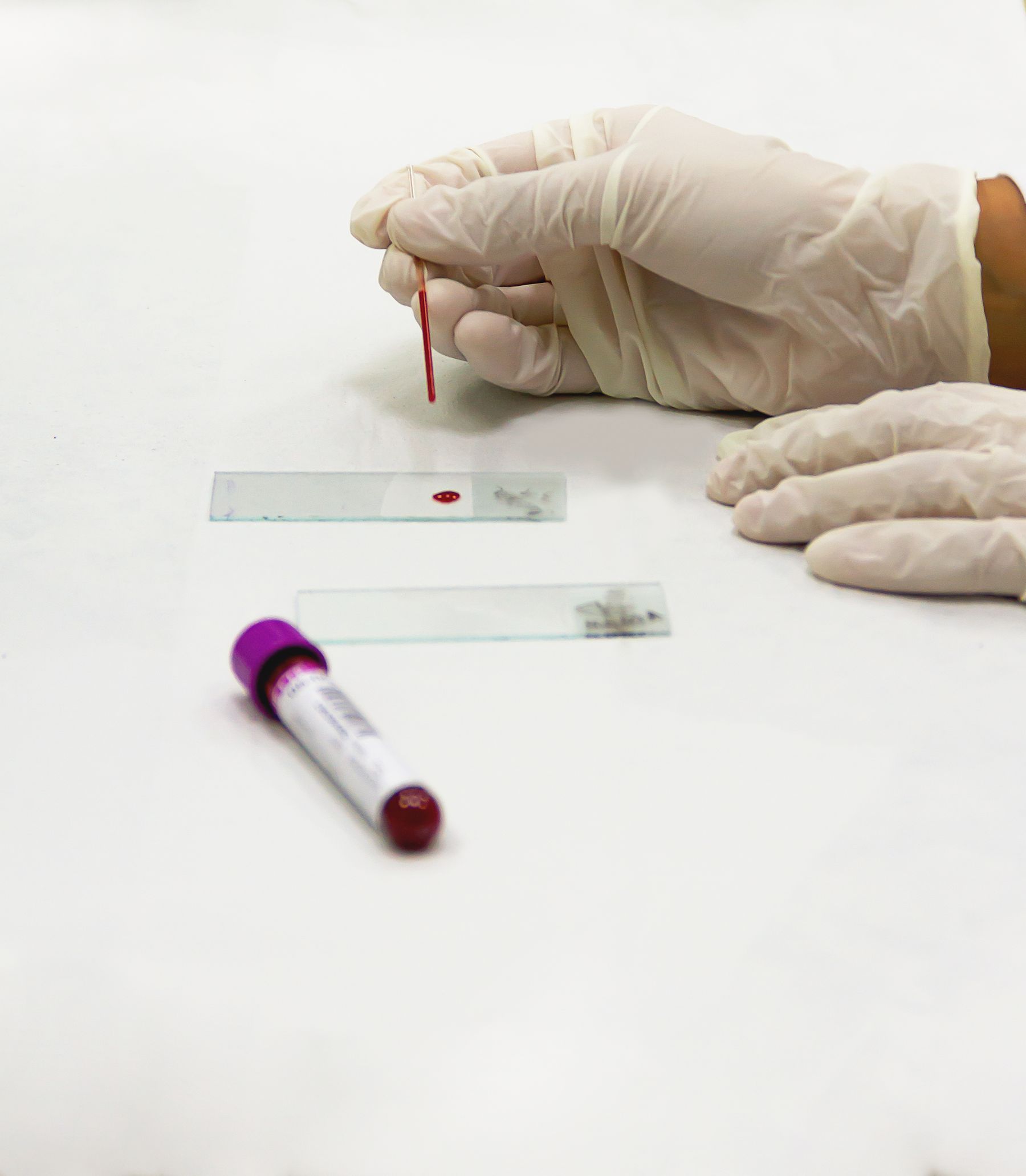 Laboratory professional preparing a blood sample for testing